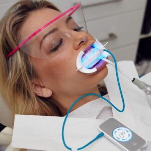 chairside whitening with autoclavable mp